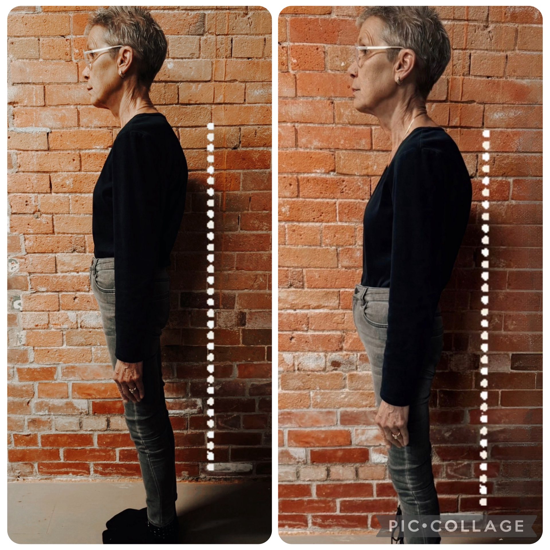 Bilan postural initial